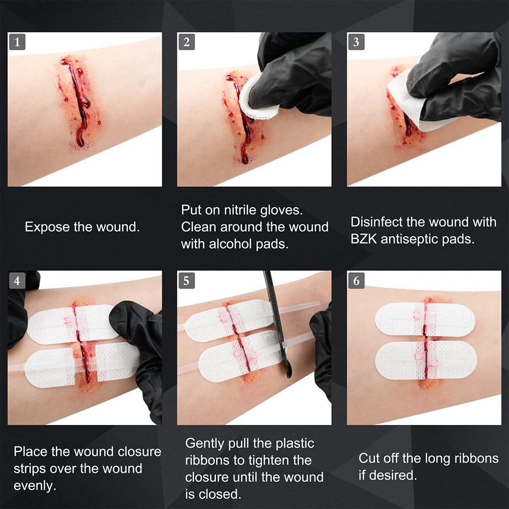 Zip Stitch 6pcs with Wound Dressings, Wound Closure Strips, Zip stitch Laceration Closure Kit for Cut Care