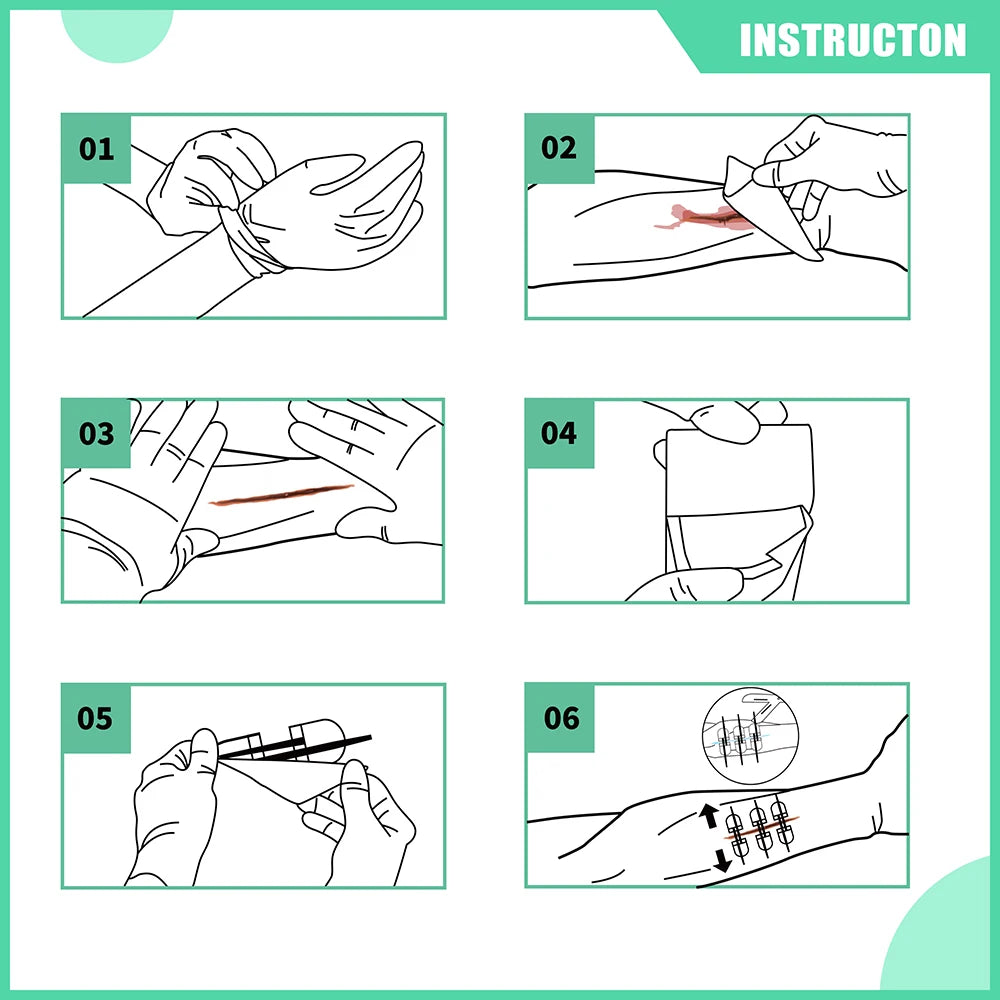 Zip Stitch 6pcs with Wound Dressings, Wound Closure Strips, Zip stitch Laceration Closure Kit for Cut Care