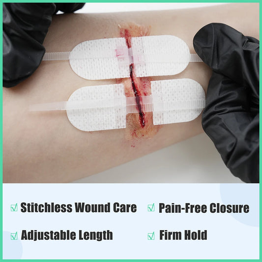 Zip Stitch 6pcs with Wound Dressings, Wound Closure Strips, Zip stitch Laceration Closure Kit for Cut Care